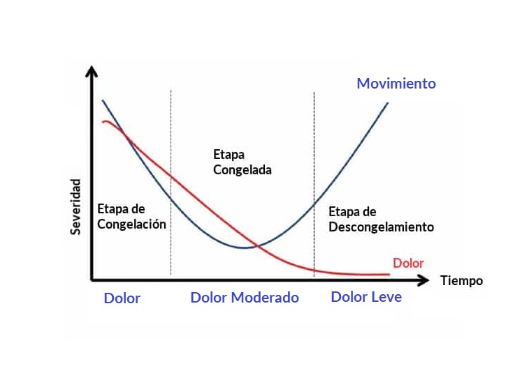 Curva de progreso para el desarrollo del Hombro Congelado Curva de progreso para el desarrollo del Hombro Congelado